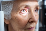 Glaucoma symptoms, Glaucoma doctors, all about the eye disease glaucoma, Symptoms