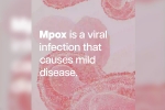 mpox cases, mpox mortality rate, mpox emergency again, Congo dr