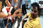 Nodia Amity attack, Harsh Yadav attack, social media demands justice for two noida students who are brutally attacked, Feminism