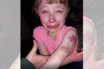 lilly special needs child, Lynn Waldron-Moehle, 10 year old special needs child brutally bitten on arm while returning home in school bus, School bus