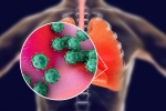 infection, ACE2 and TNPRSS2, new studies explain how the coronavirus enters our body, University medical centre groningen