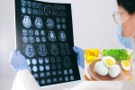Eggs and Alzheimer’s, Eggs and Alzheimer’s breakfast, eggs may help prevent alzheimer s study, Icu