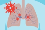 immune system, cytokine storm syndrome, how does covid 19 affect different parts of the body, Weird